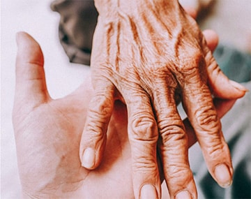 Arthritis